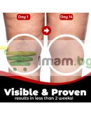 Пластири за разширени вени Varicose Care 12 броя